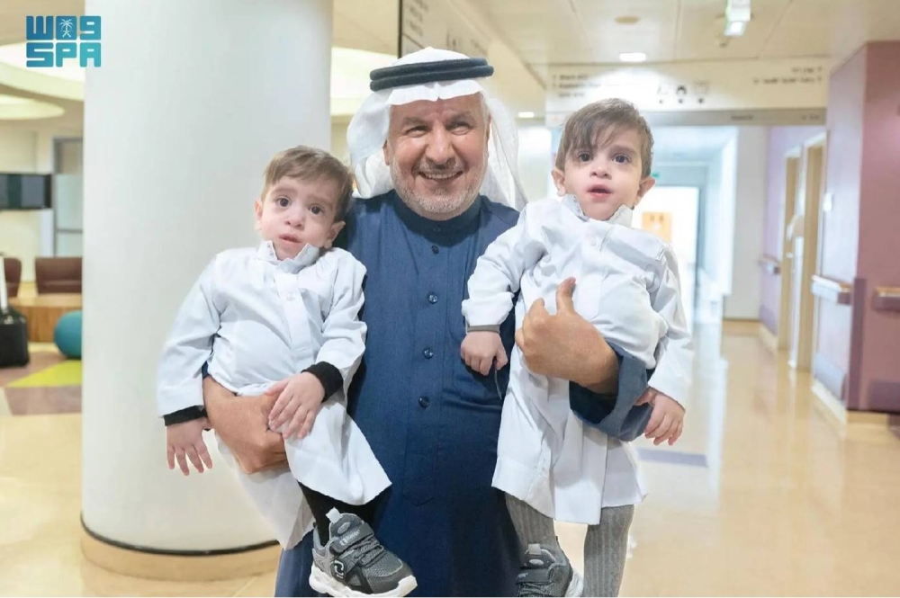 «الربيعة» يطمئن على صحة التوأم السيامي العراقي «عمر وعلي»
