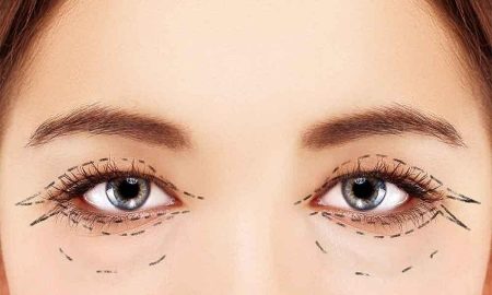 استشاري: عمليات تجميل الجفون آمنة بشرط