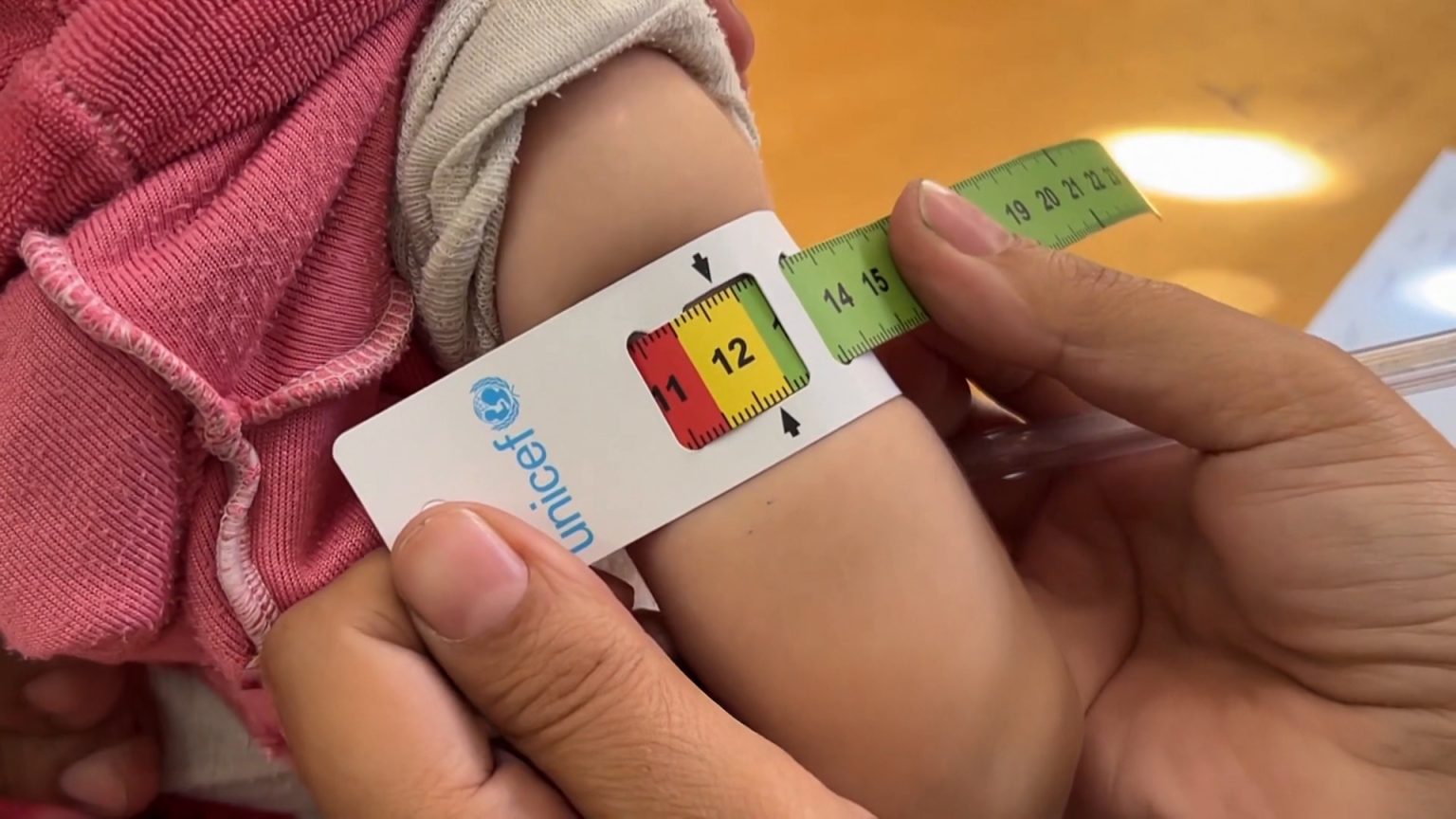 الصحة العالمية تعلن تطعيم أكثر من 10 آلاف طفل في غزة