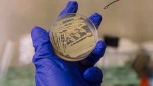 بمختبرات ناسا.. اكتشاف بكتيريا قادرة على “التظاهر بالموت”