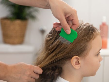 3 خطوات للتخلص من القمل