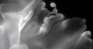 حيوان “بلا دماغ” في البحر الأحمر.. كيف يطوي جسده بدقة الأوريغامي؟