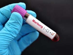 إثيوبيا تعلن احتواء فيروس ماربورغ