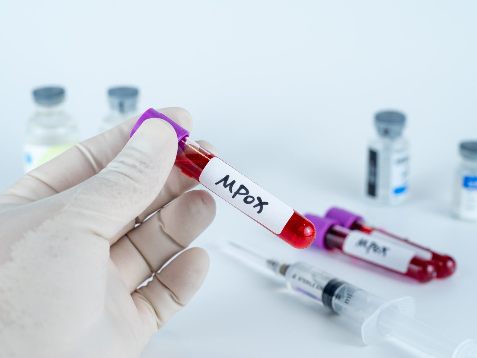 أفريقيا ترفع حالة الطوارئ الصحية بشأن جدري القردة بعد تراجع الإصابات