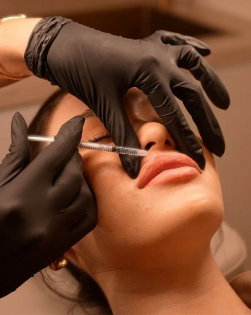 هل انتهى عصر الشفاه الروسية؟ – أخبار السعودية