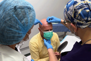 زراعة الشعر ببيوفايبر نتائج فورية بتقنية حديثة